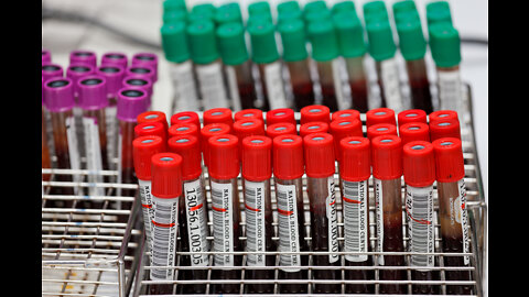 Vaxxed Blood Under Microscope- Compilation Of Research From Numerous Separate Investigations