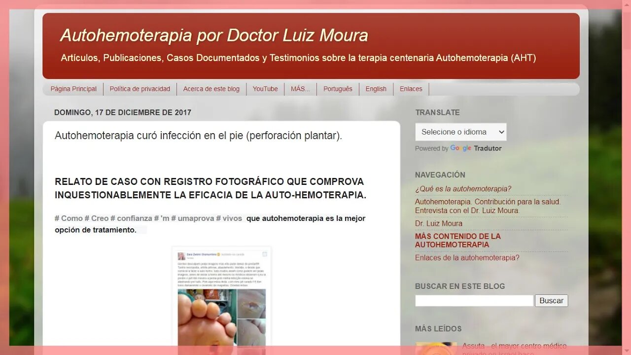 Autohemoterapia cura infección del pie, la enfermedad perforante plantar, testimonio de Daia