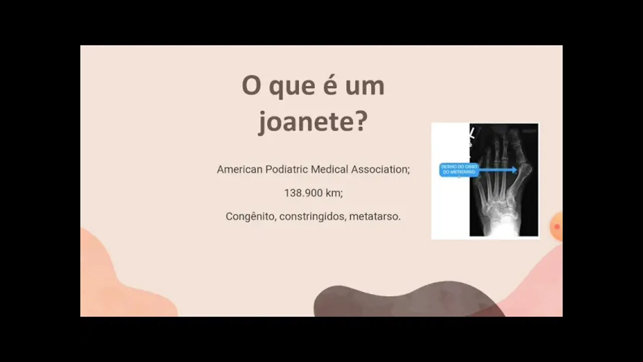 [pt. 1] Joanetes: causas, sintomas e tratamentos