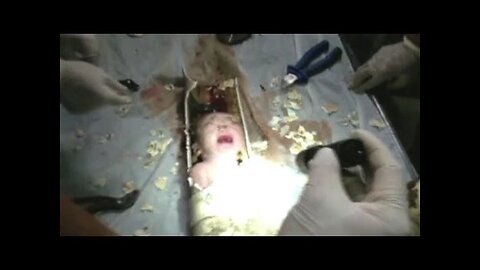 Rescuers save newborn from sewer pipe