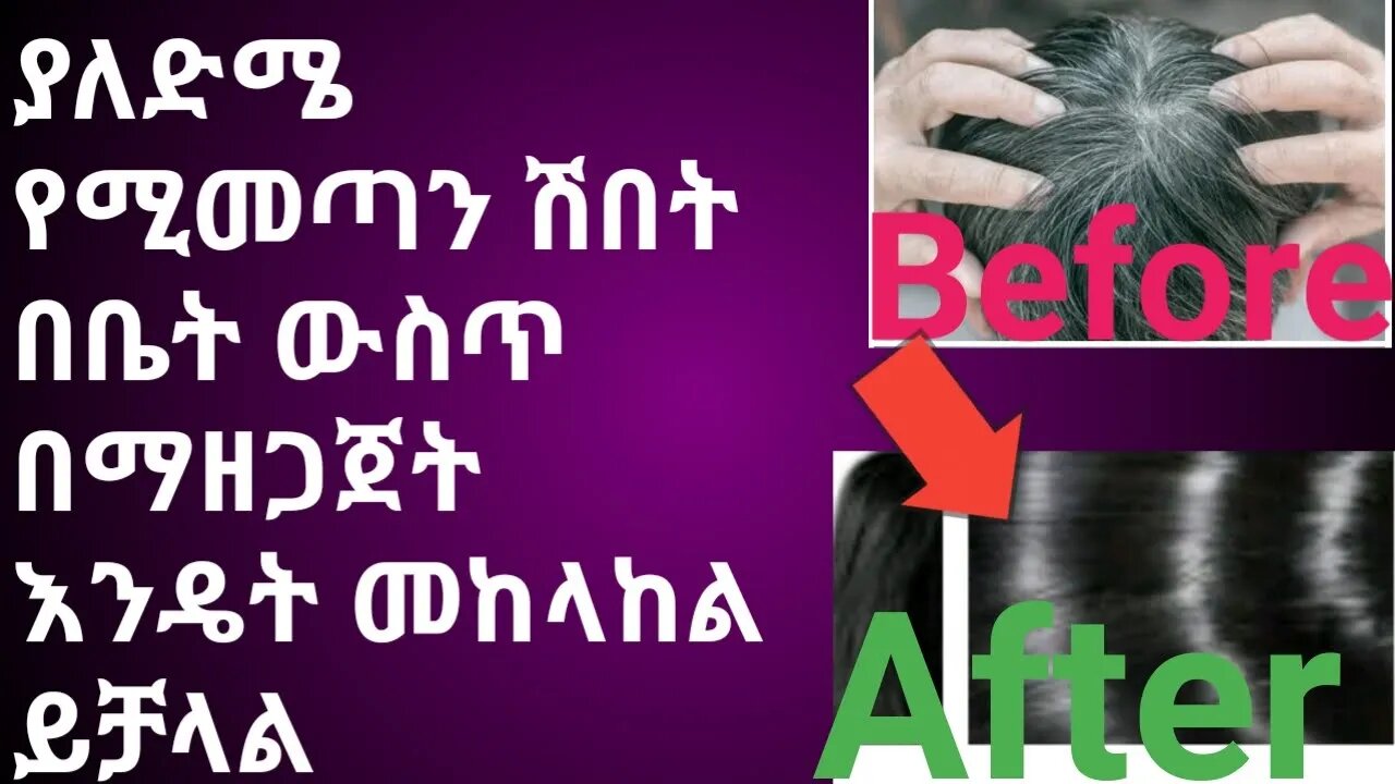 ያለእድሜ የሚመጣ የፀጉር ሽበት በቤት ውስጥ በማዘጋጀት እዴት መከላከል ይቻላል |#new_tube