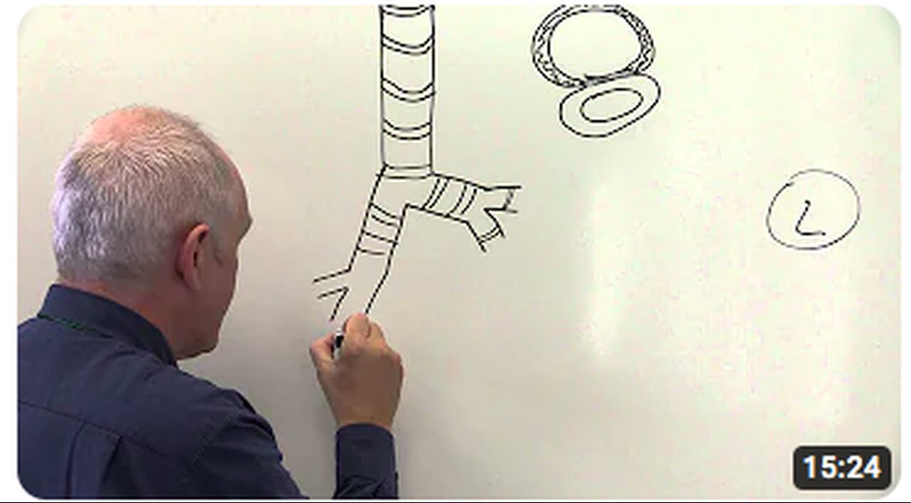 Respiratory System 1, Lungs, chest wall and diaphragm