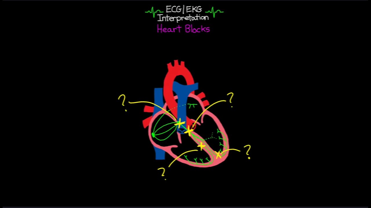 Heartblocks Made Easy