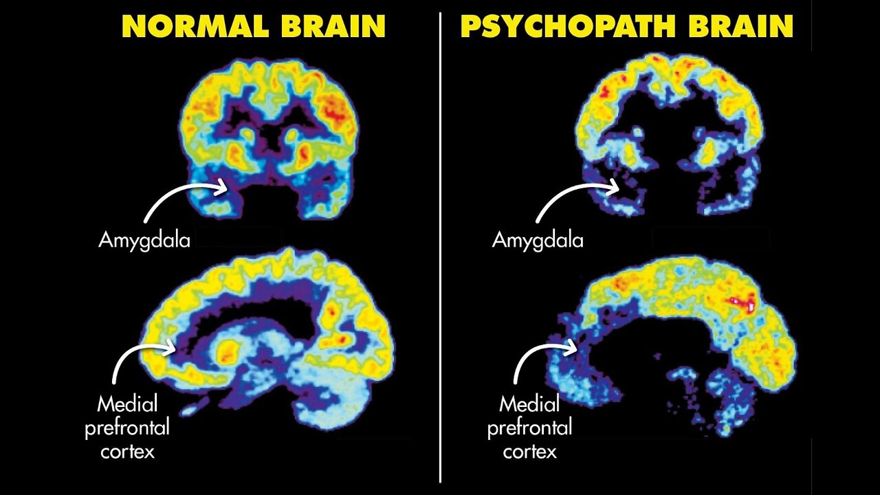 What It is: Humanity Vs. Psychopaths.