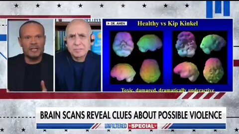 Child Psychiatrist Provides A Look Inside The Mind Of a School Shooter