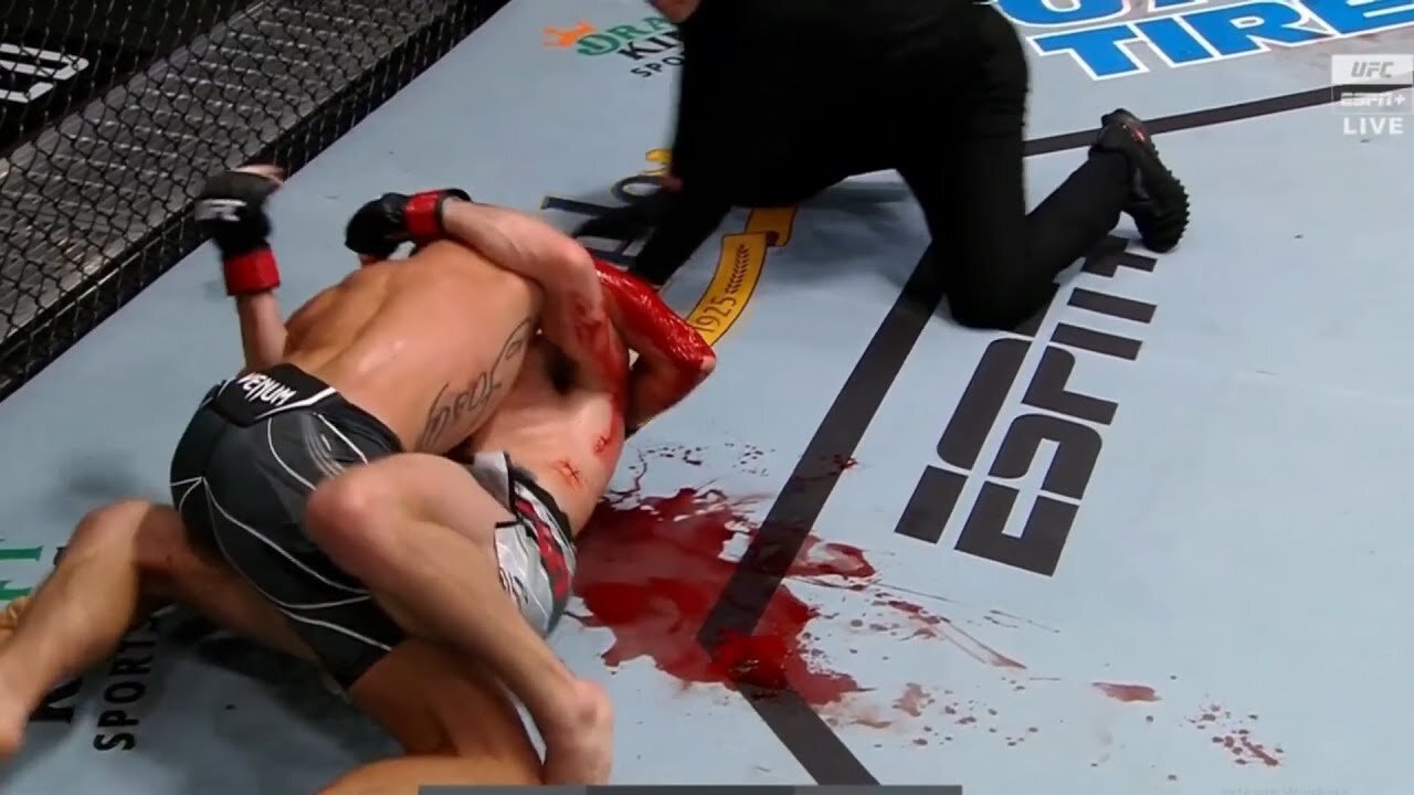ARE YOU A FIGHTER? FIGHTERS ARE AWESOME (UFC)
