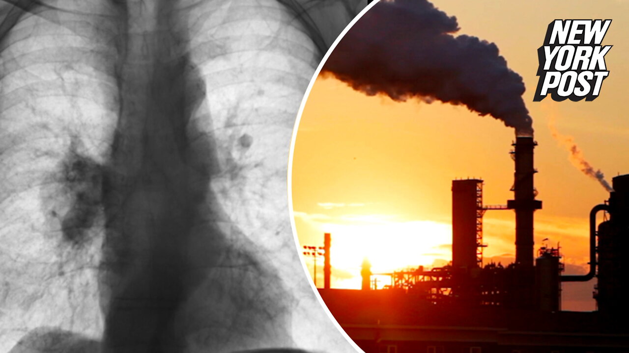 Air pollution can cause lung cancer – without mutating cells