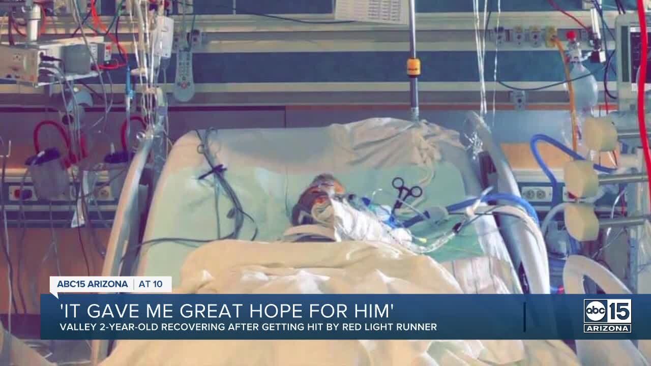 Two-year-old boy takes his first steps after hit and run crash