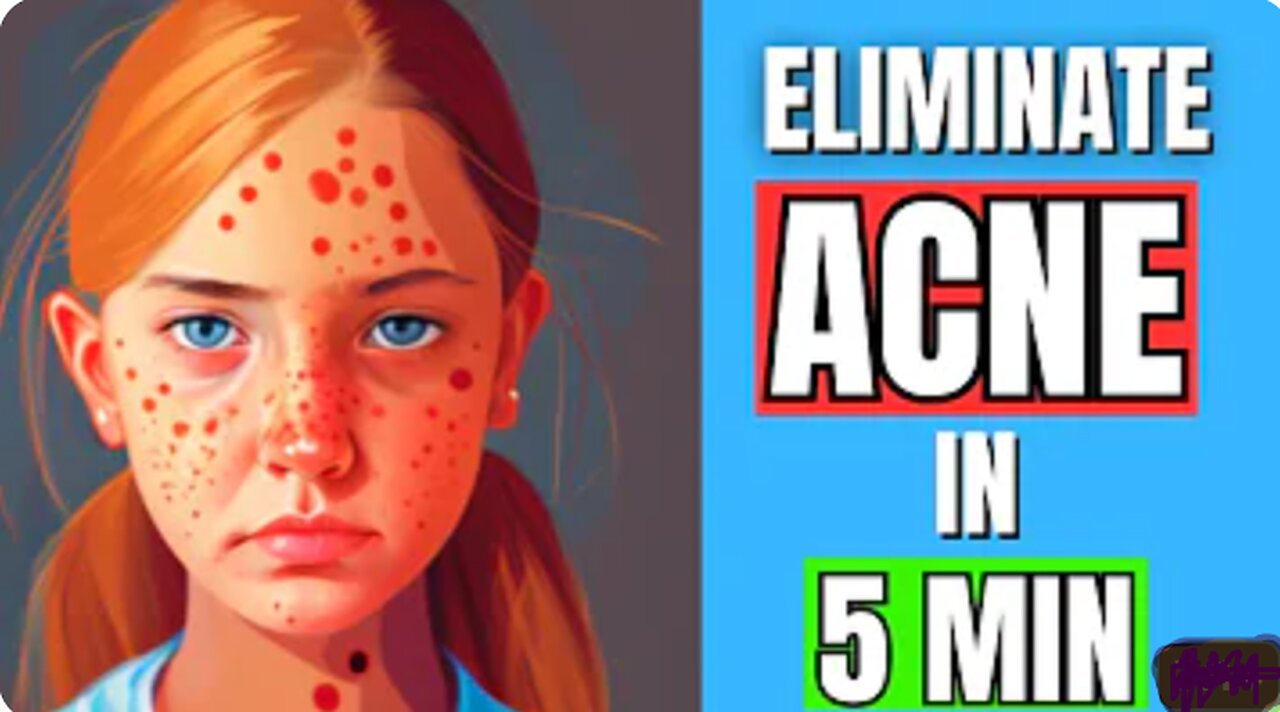 5 Simple Steps to Get Clear and Glowing Skin - Say Goodbye to Pimples and Blackheads