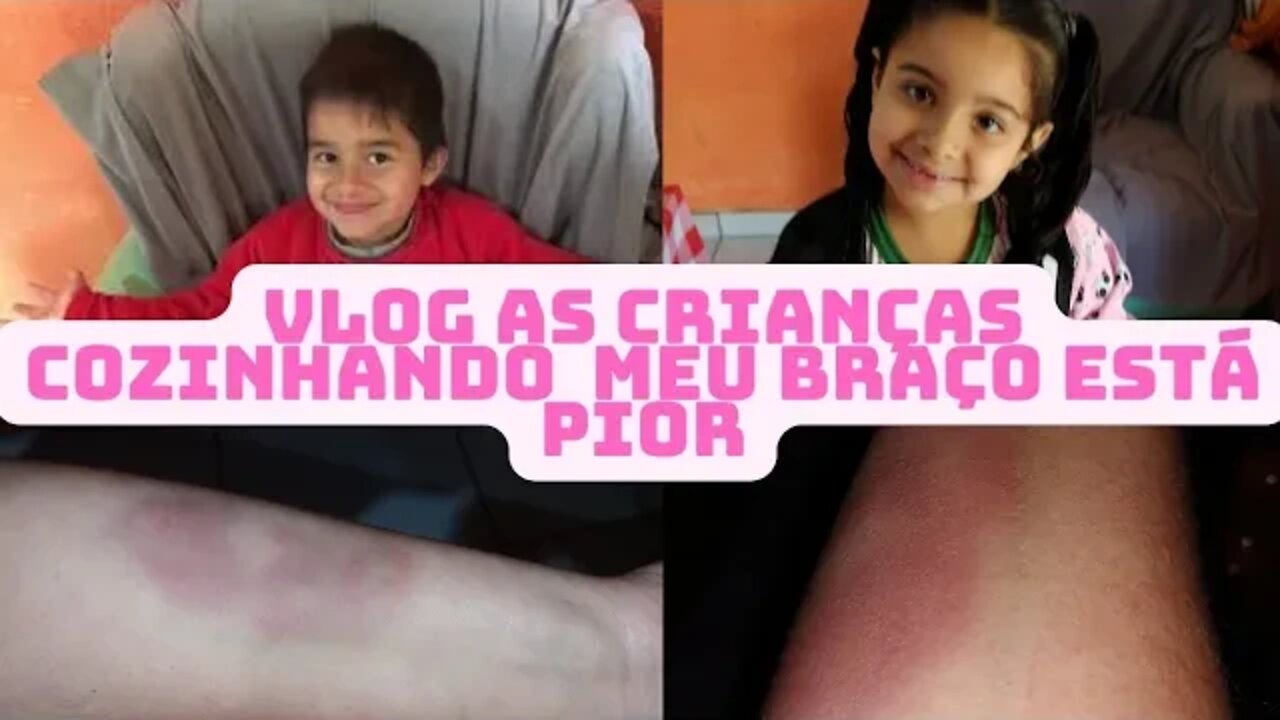 VLOG cozinhando com as crianças Meu braço machucado Marquei exame de vista