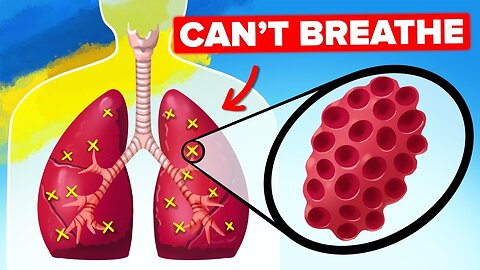 Russia's Insane Weapon That Rips Oxygen from Soldier's Lungs