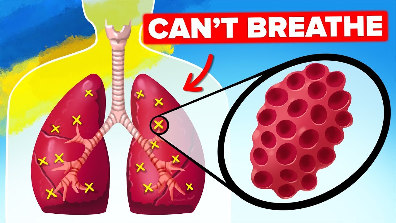 Russia's Insane Weapon That Rips Oxygen from Soldier's Lungs
