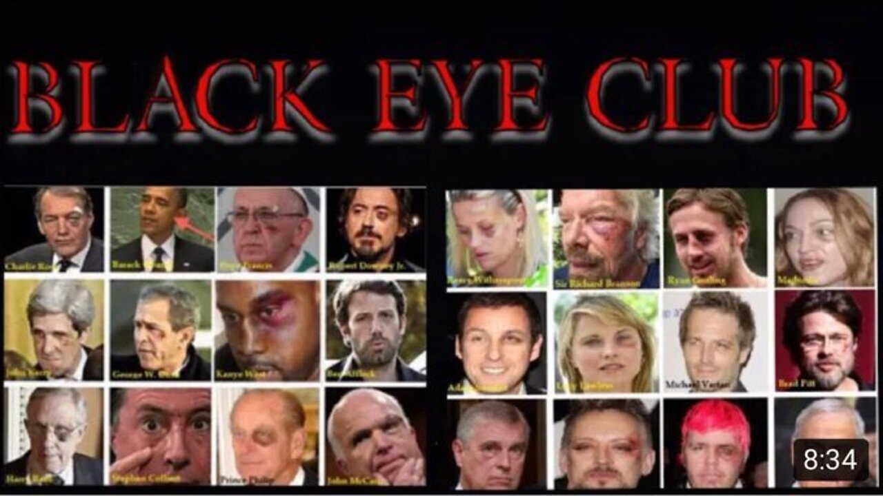 CELEBRITIES IN THE “BLACK EYE CLUB” DAVID ZUBLICK & JESSIE CZEBOTAR. Micah 2;1-2 “Woe to them”