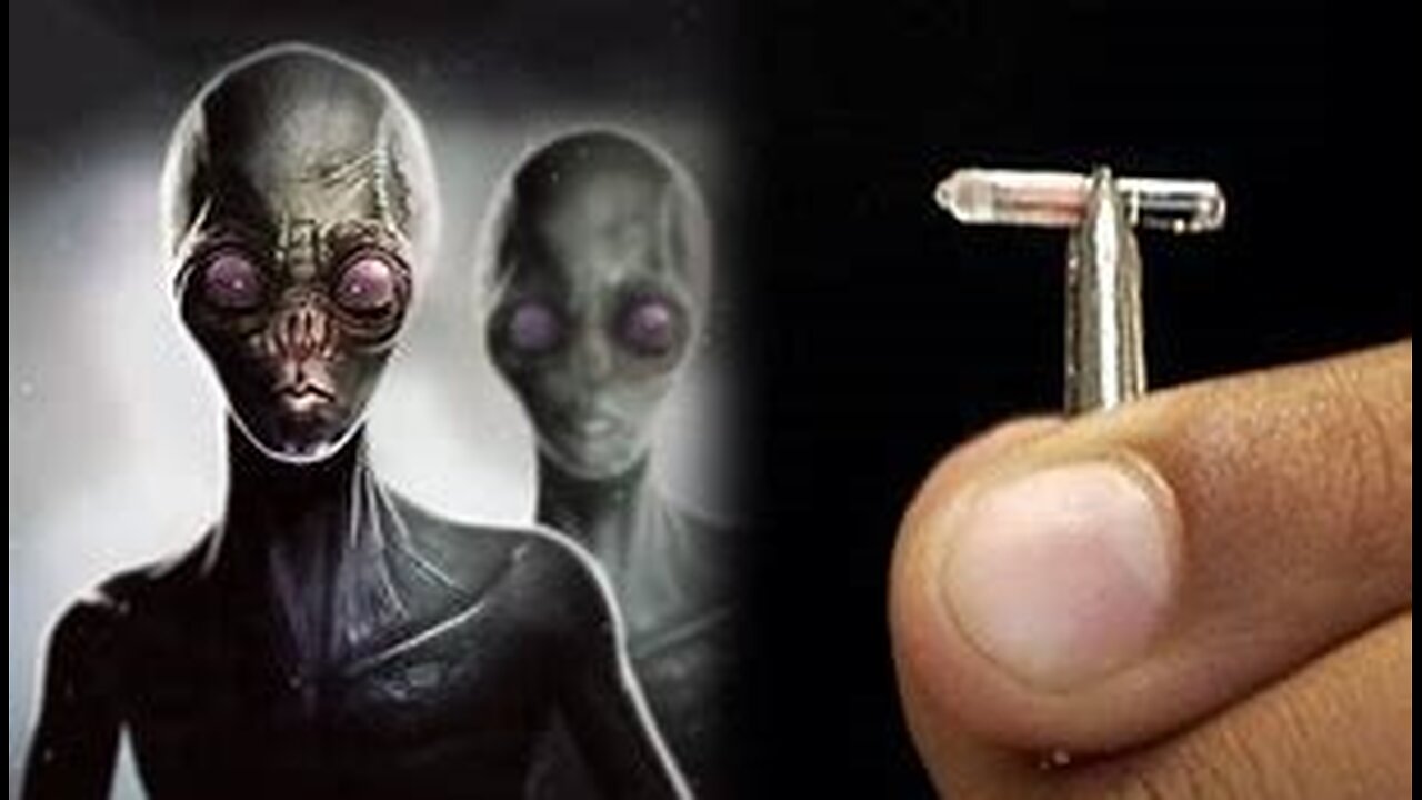 Possible UFO Abductee Extracts Alien Implant