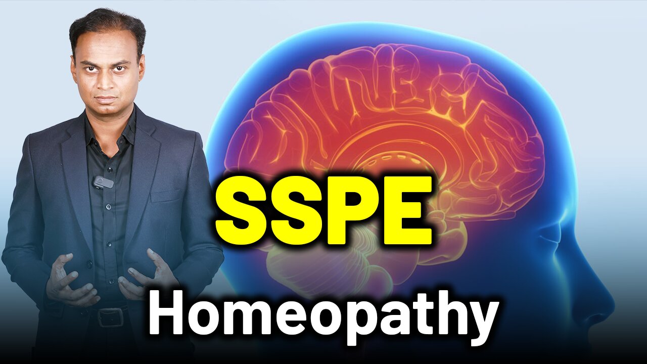 SSPE, Subacute Sclerosing Panencephalitis, Dowson Disease . | Dr. Bharadwaz | Homeopathy,