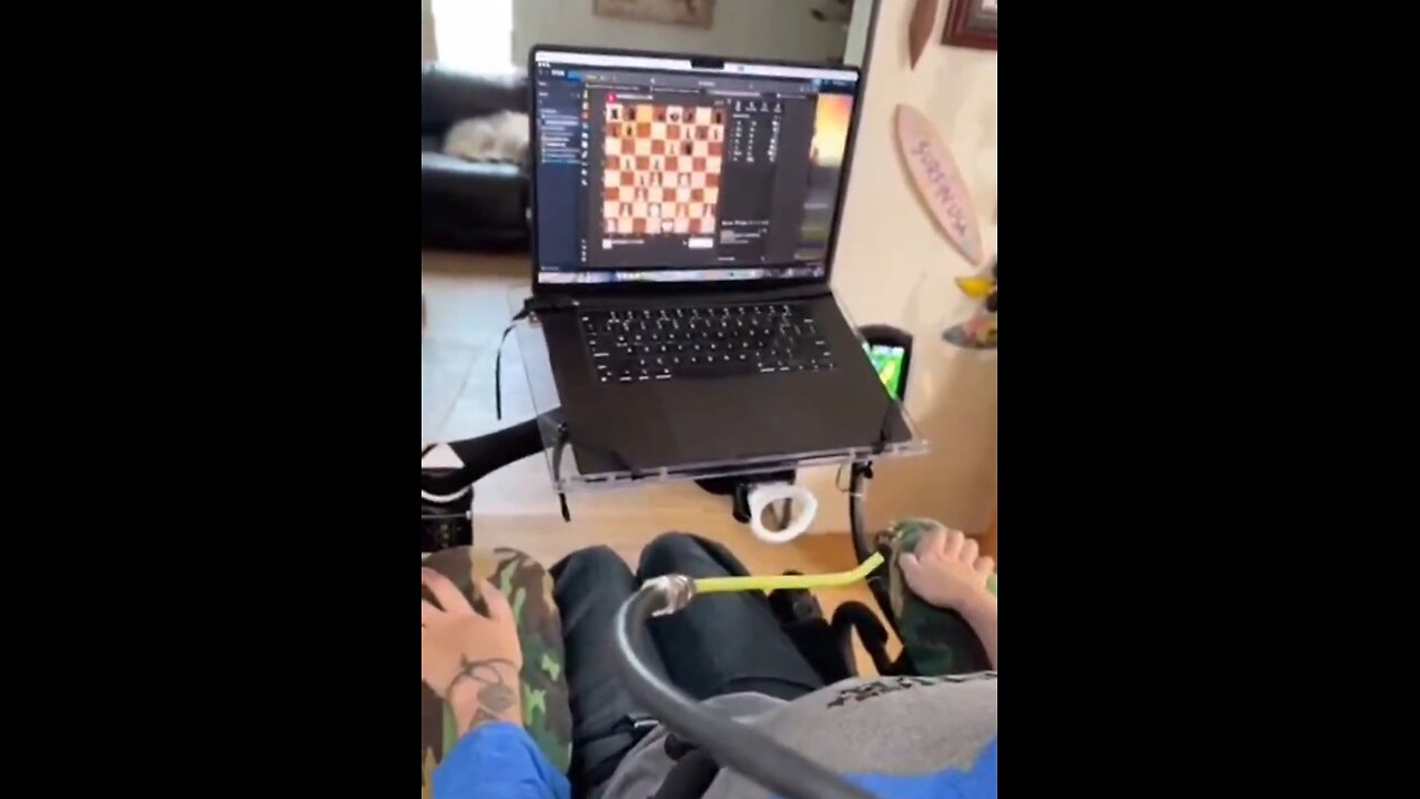 First Look At Elon Musk's Neuralink Shows Paralyzed Man Playing Chess With His Mind