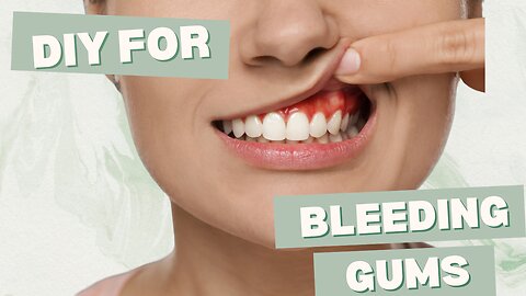 DIY for Bleeding Gums