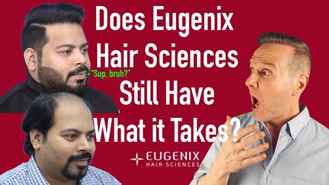 The Best Hair Transplants in India? New Massive Results!