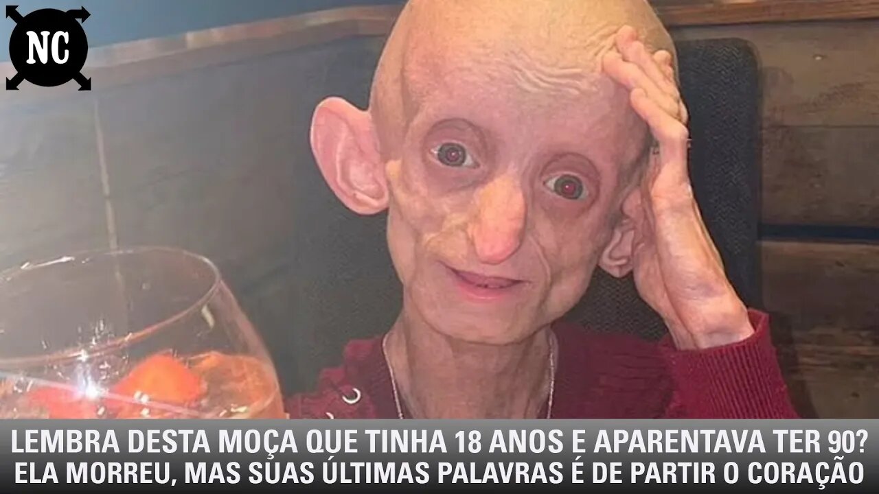 Lembra desta moça de 18 anos que aparentava ter 90? Ela morreu e suas últimas palavras é de partir..