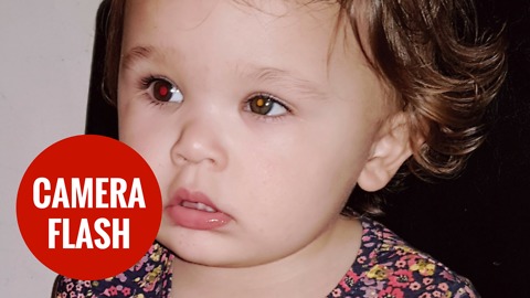 Mum saves her daughters sight - using the flash on her camera phone.