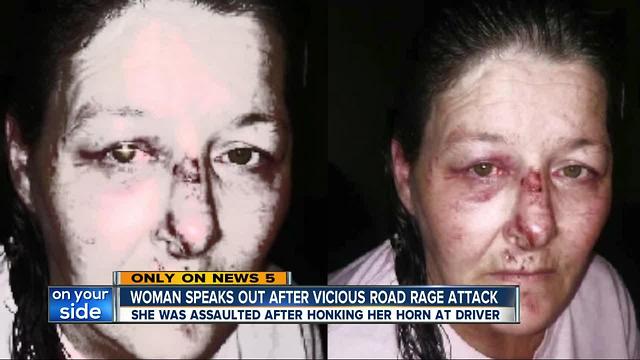 Akron woman left bloodied and bruised after alleged road rage incident