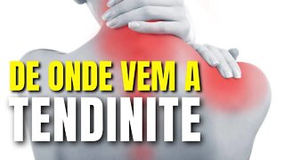 Tendinite - O Que Pode Causar Tendinite e Bursite