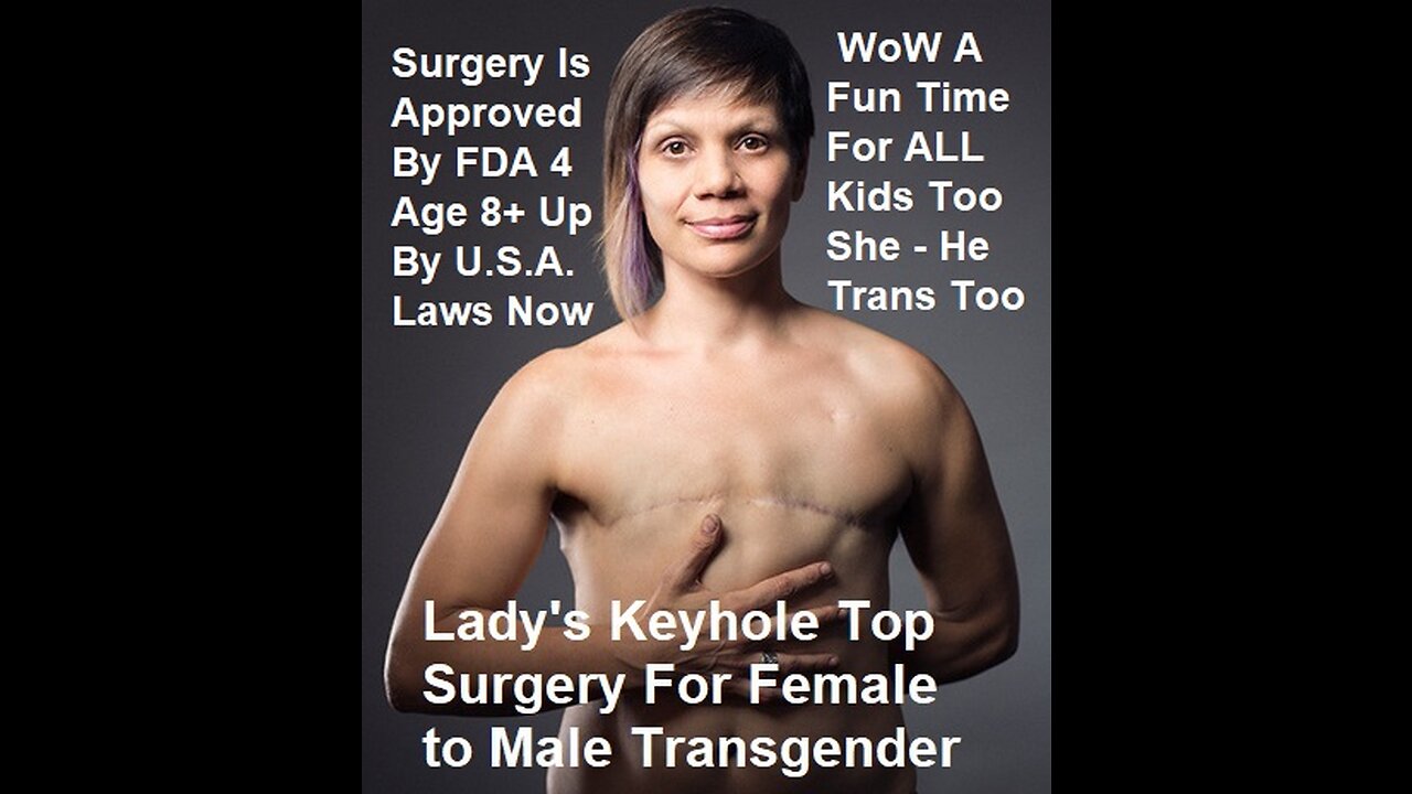 WoW This Looks Fun Lady's Keyhole Top Surgery For Female to Male Transgender