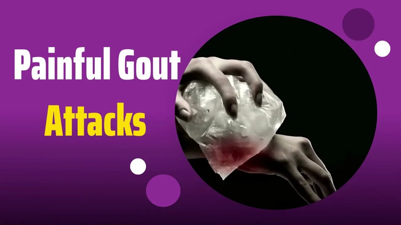 Painful Gout Attacks [gout treatment for pain] #shorts