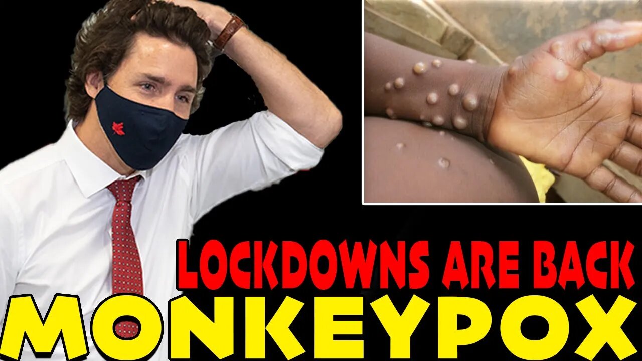 🚨 IT'S HERE!! DEADLY MONKEYPOX VIRUS ARRIVES FOR MIDTERMS