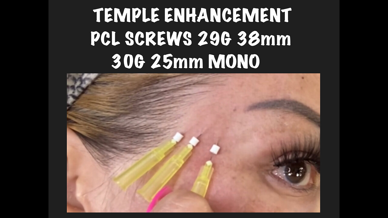 Temple And Jawline Enhancement