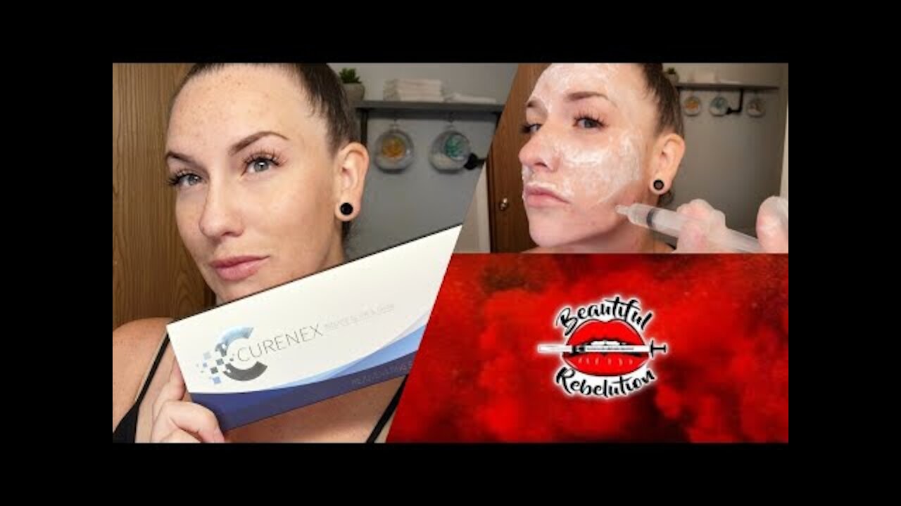 Curenex Skin Booster | CelestaPro