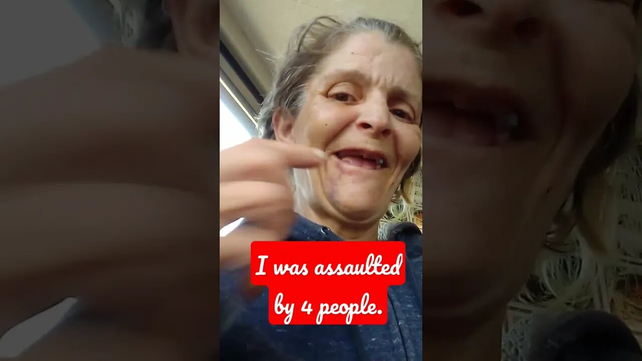 I was assaulted by 4 people and tazered almost a week ago. They even knocked out a tooth.