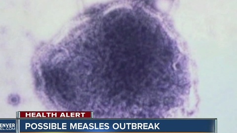 Possible measles exposure in Denver/Boulder area