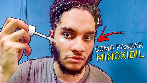 COMO PASSAR MINOXIDIL CORRETAMENTE NA BARBA *passo a passo* ✅️
