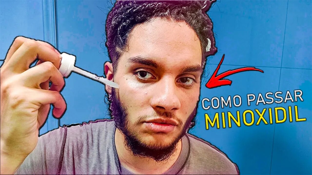 COMO PASSAR MINOXIDIL CORRETAMENTE NA BARBA *passo a passo* ✅️