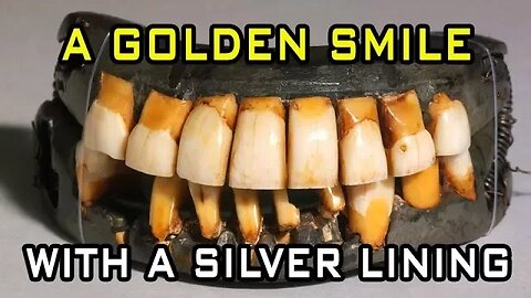 Washington's False Teeth: A Golden Smile With A Silver Lining