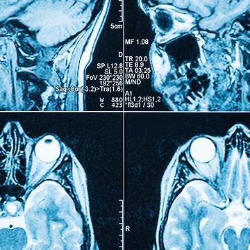 5 Things That Happen When You Drink