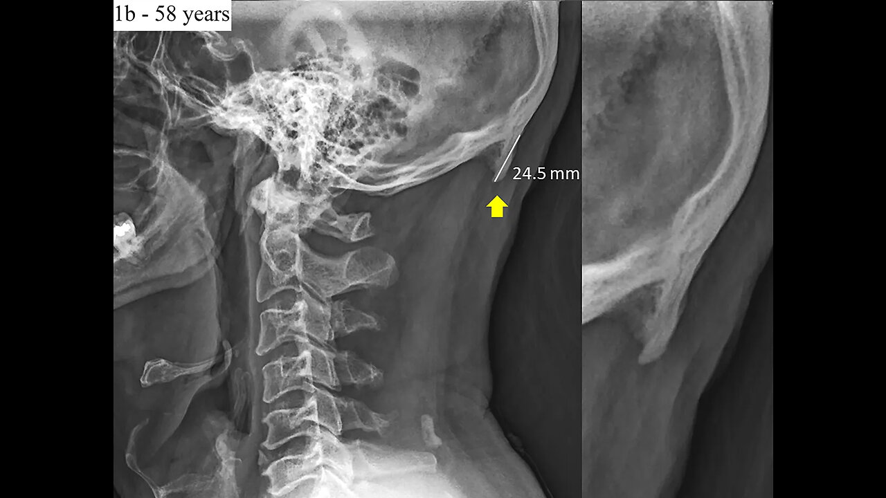 {REPOST} YOU WON'T BELIEVE THE DAMAGE THAT CELLS PHONES ARE DOING TO PEOPLE NOW...