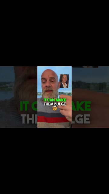 How Do Hemorrhoids Form?