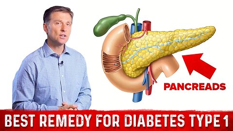 Best Remedy For Type 1 Diabetes – Dr. Berg on Diabetes Treatment