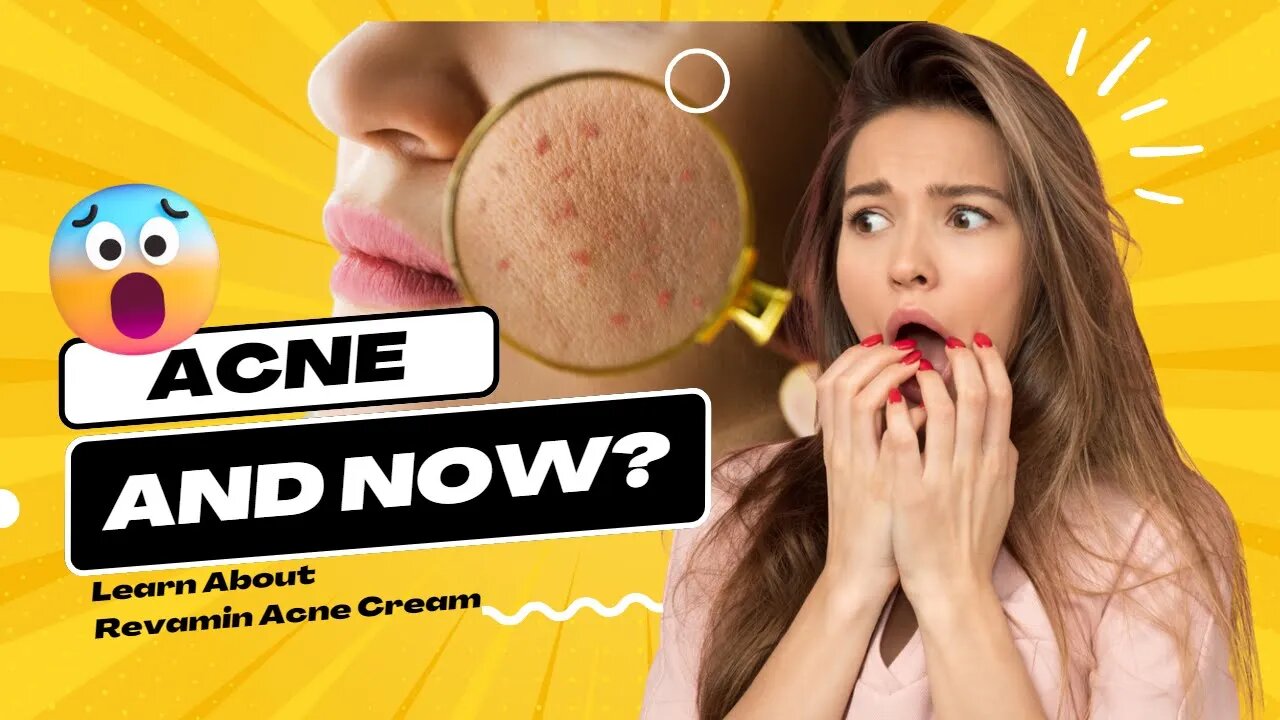 What is the Phenomenon of Revamin Acne Cream? Revamin Acne Cream