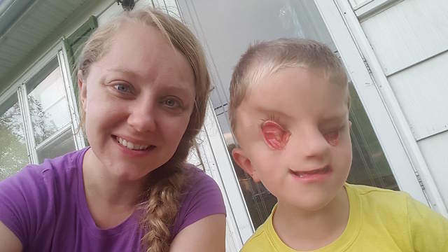 Boy Born With No Eyes Is Living His Life To The Fullest