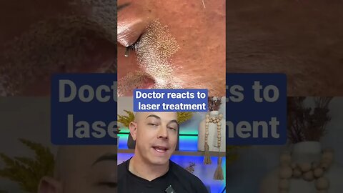 Derm reacts to crazy laser demonstration!