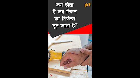 घाव कैसे भरता है *