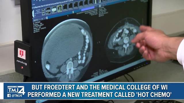 Delavan woman finds 30 pounds of tumors in her stomach
