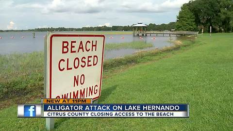 Gator attacks woman in Citrus County