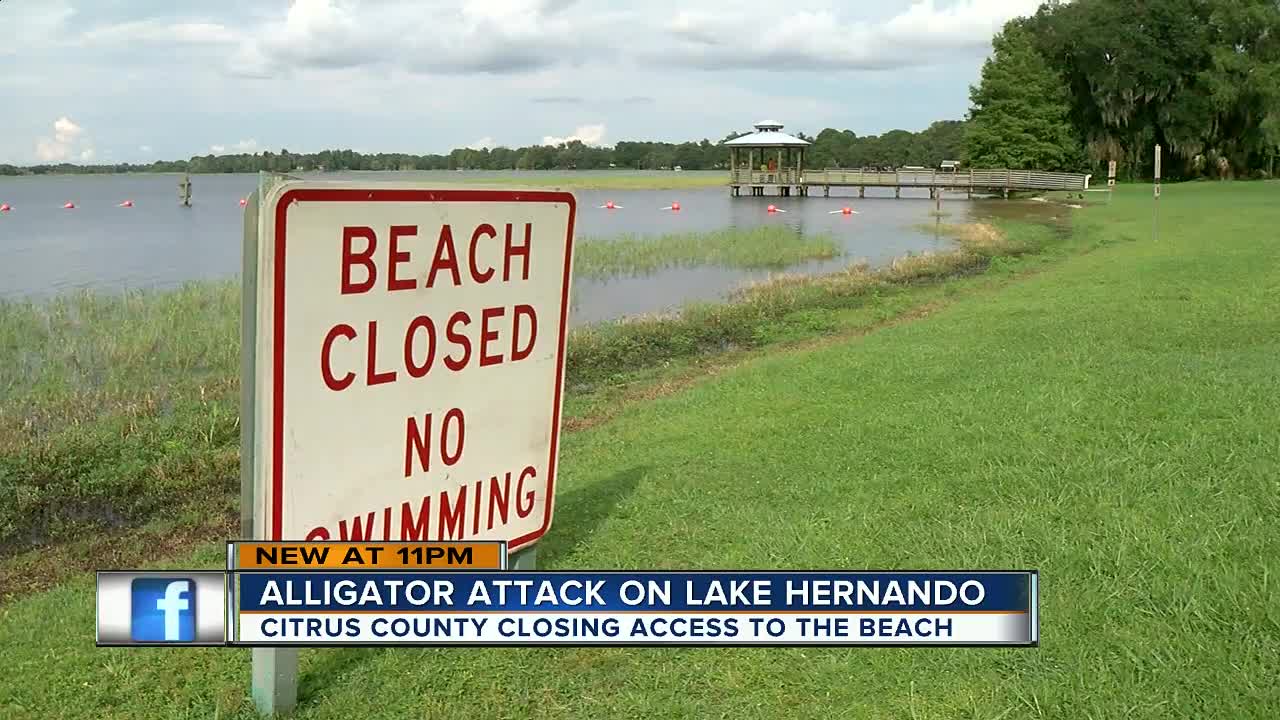 Gator attacks woman in Citrus County