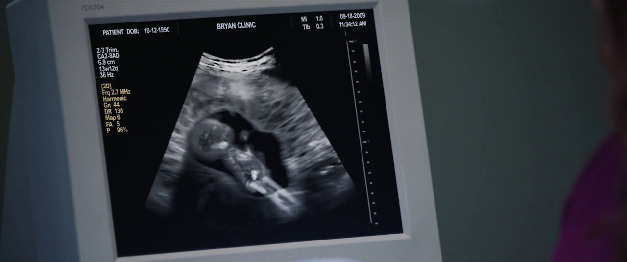 Inesperado - Unplanned - 2019