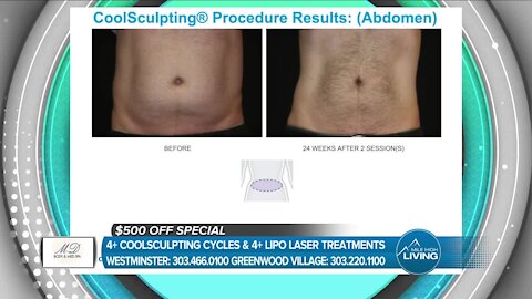 MHL - MD Body and Med Spa // Coolsculpting