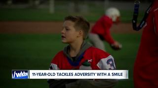 11-year-old tackles adversity with a smile